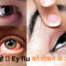 Eye flu