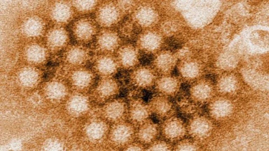 Norovirus Surge 